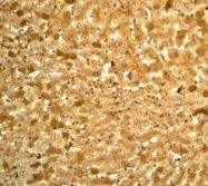 NBP1-40521 - Transthyretin / Prealbumin