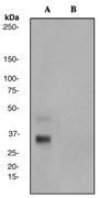 NBP1-40539 - ATF1