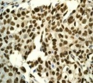NBP1-40539 - ATF1