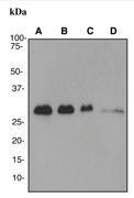 NBP1-40544 - RPA2