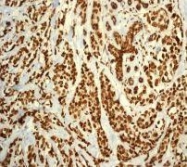 NBP1-40544 - RPA2