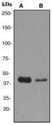 NBP1-40561 - TRIB3