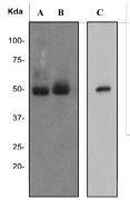 NBP1-40582 - VTCN1 / B7H4