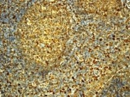 NBP1-40582 - VTCN1 / B7H4
