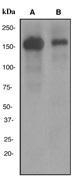 NBP1-40605 - CD21