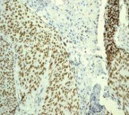 NBP1-40642 - RPA1