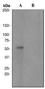 NBP1-40676 - PRKAR2B
