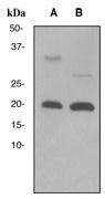 NBP1-40687 - Interleukin-2 / IL2