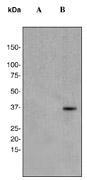 NBP1-40765 - NFKBIA / IKBA