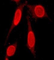 NBP1-40777 - Estrogen receptor beta