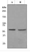 NBP1-40777 - Estrogen receptor beta