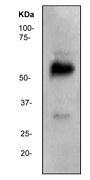 NBP1-40787 - WT1 / Wilms tumor protein