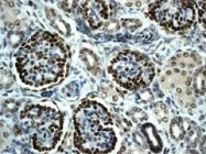 NBP1-40787 - WT1 / Wilms tumor protein