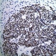 NBP1-40787 - WT1 / Wilms tumor protein