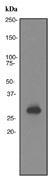 NBP1-40797 - OTX2