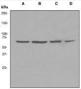 NBP1-40806 - XRCC6 / Ku70