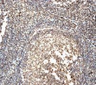 NBP1-40806 - XRCC6 / Ku70