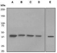 NBP1-40810 - ACADM