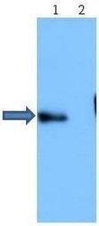 NBP1-44047 - Amyloid beta
