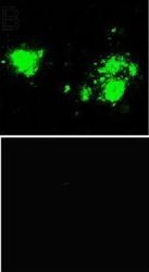 NBP1-44048 - Amyloid beta