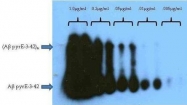 NBP1-44048 - Amyloid beta