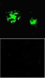 NBP1-44070 - Amyloid beta