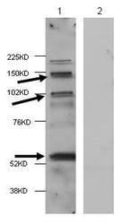NBP1-44094 - HDAC4