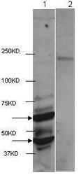 NBP1-44095 - HDAC2