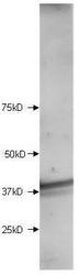 NBP1-44267 - HDAC11