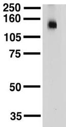NBP1-44508 - KCNT1