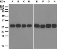 NBP1-95196 - 14-3-3 protein zeta/delta