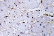 NBP1-00706 - AKAP13
