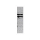 16520002 - BACE2