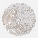 17190002 - TSP50 / CT20