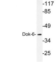 NBP1-19689 - DOK6 / DOK5L