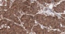 19510002 - Serotonin receptor 2B (HTR2B)