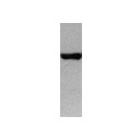 20380002 - BRCA1 / RNF53