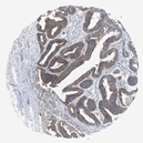 20900002 - USH1C / Harmonin