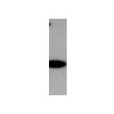 21370002 - Myosin-14 / MYH14