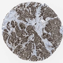21580002 - Nuclear protein NP60 / N-PAC