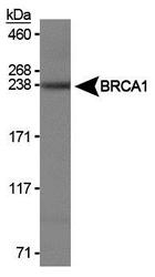 NB100-598 - BRCA1 / RNF53