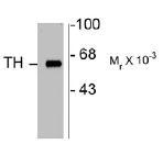NB300-109 - Tyrosine 3-monooxygenase (TH)