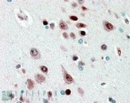 NBP1-00221 - NOVA1