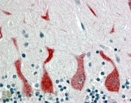 NB300-969 - RAR-alpha / RARA