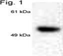 NB300-719 - Estrogen receptor beta