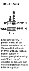 30170002 - Protein phosphatase 1H / PPM1H