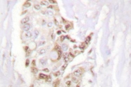 NB100-91803 - HDAC5