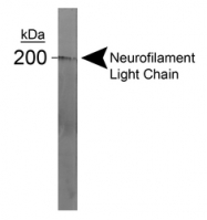 NB300-135 - Neurofilament H (200 kD)