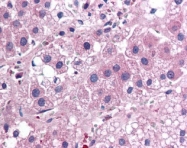 NB100-56541 - Interleukin-25 / IL25