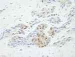 NB100-2859 - TP53BP2